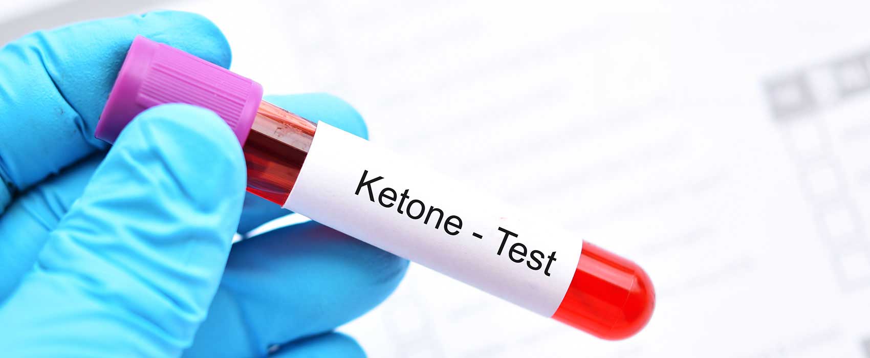 ketone test vial
