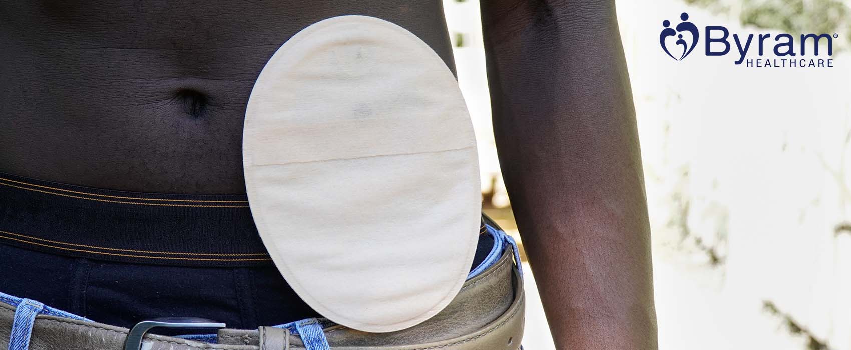 Man with an ostomy pouch.