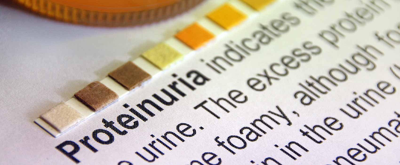 proteinuria