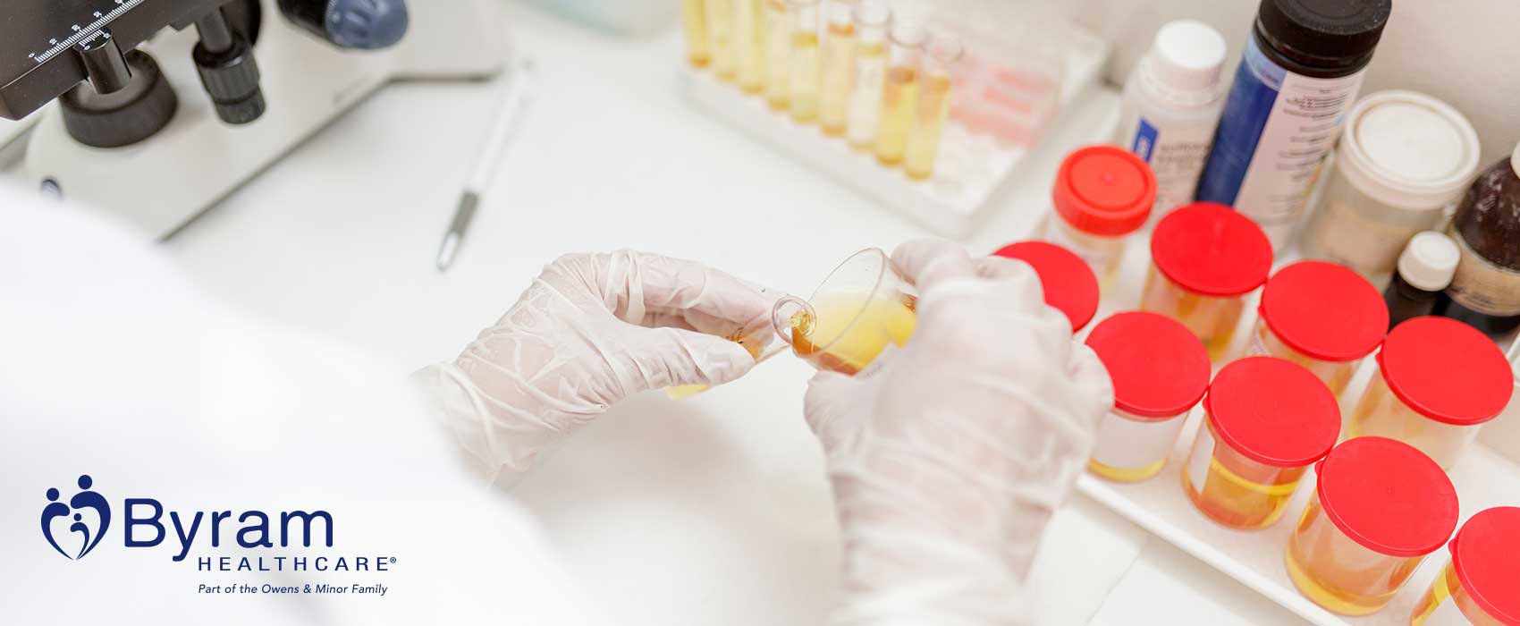 Person handling urine sample in a lab.