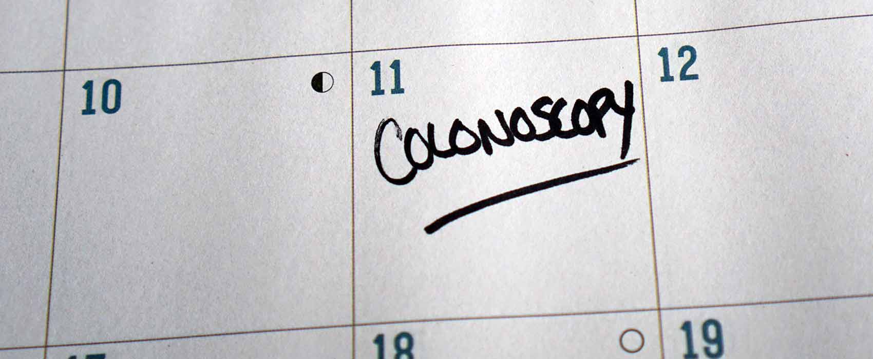colonoscopy on calendar