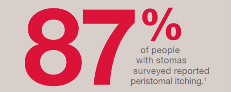 87 percent of people with stomas report itching