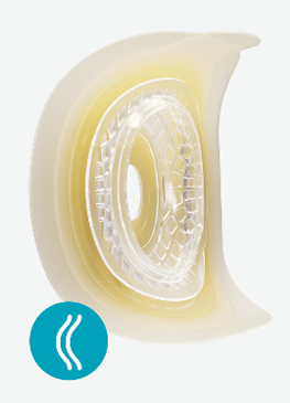 SenSura® Mio Convex Deep