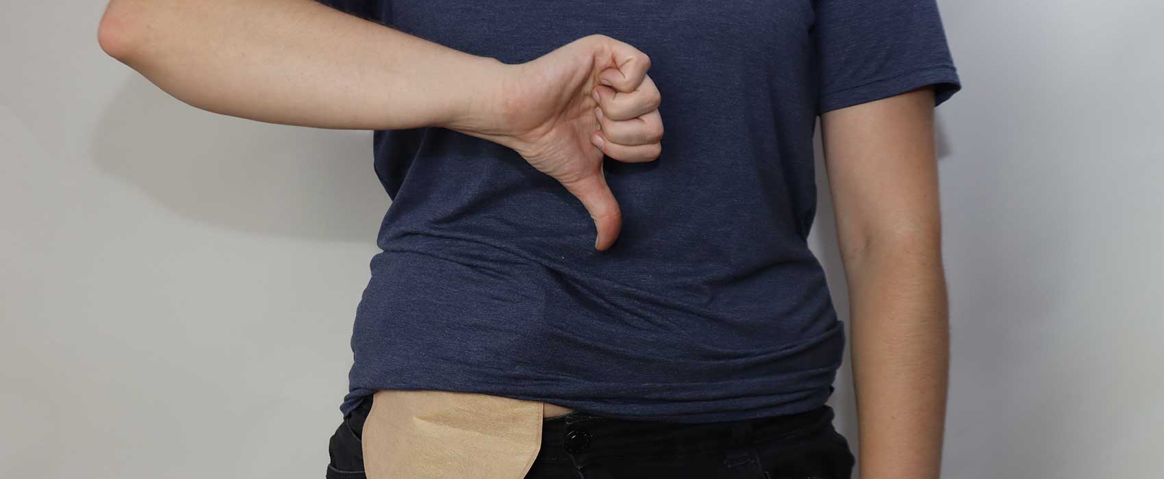man with thumbs down and ostomy